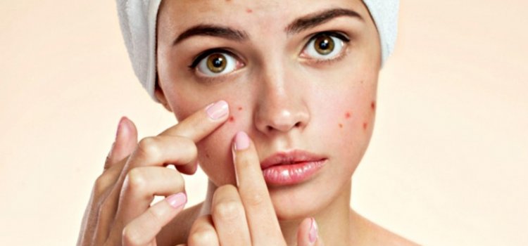 The Latest Acne Treatment Products