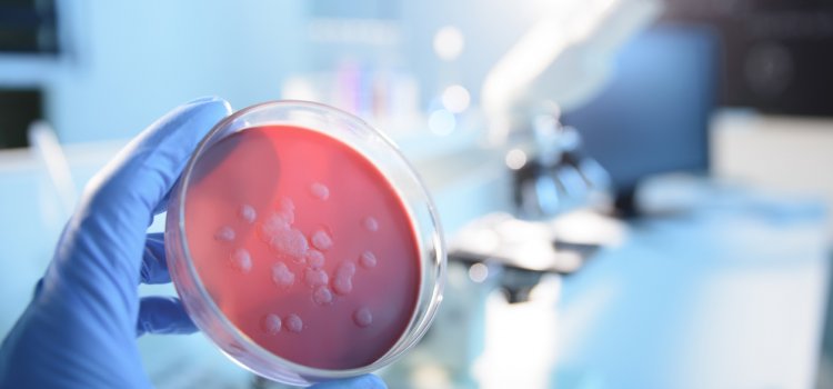 Ebola – The Facts